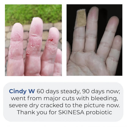Skinesa Skin Probiotic 30 Servings